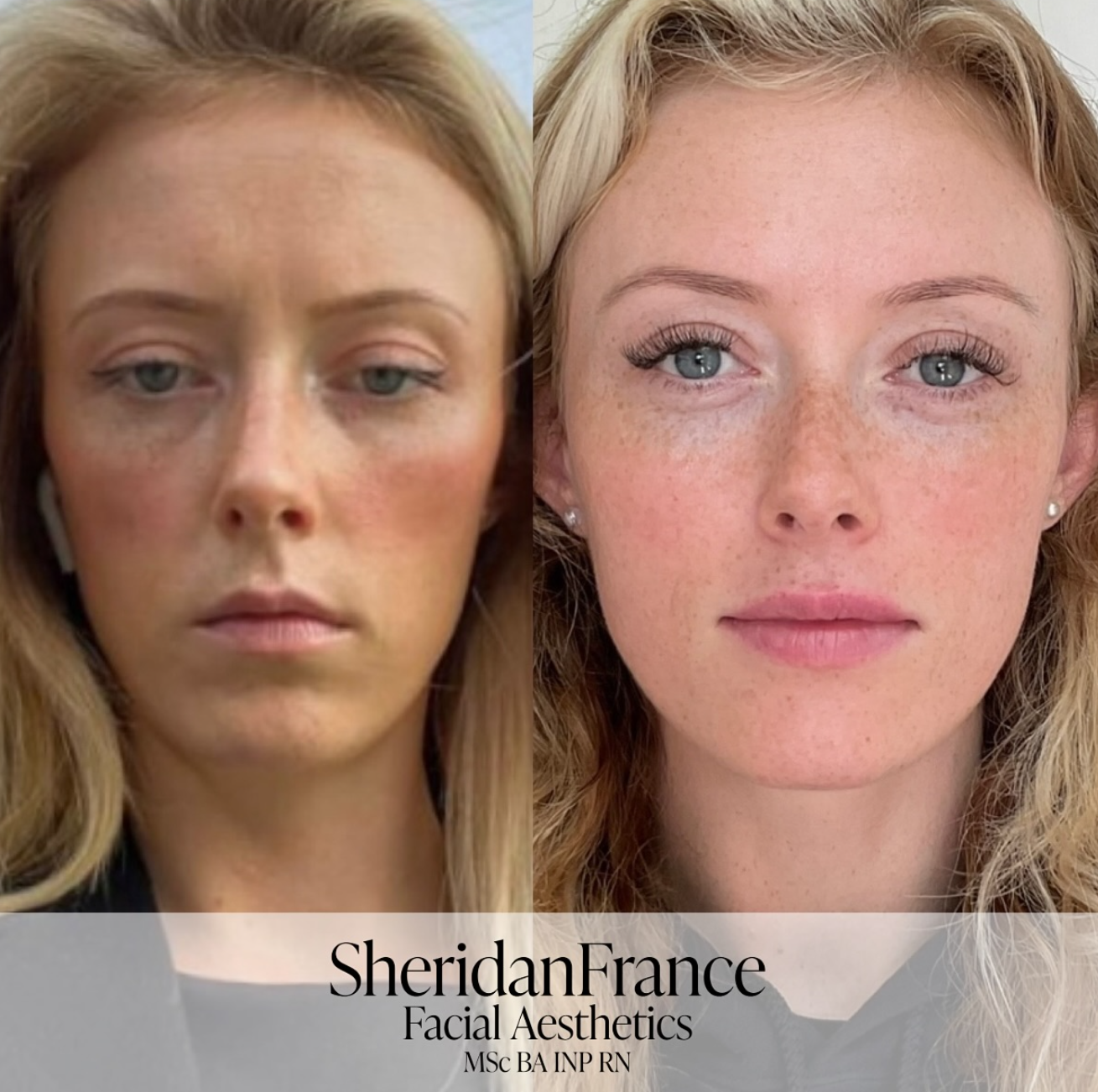Sheridan France as featured in the press